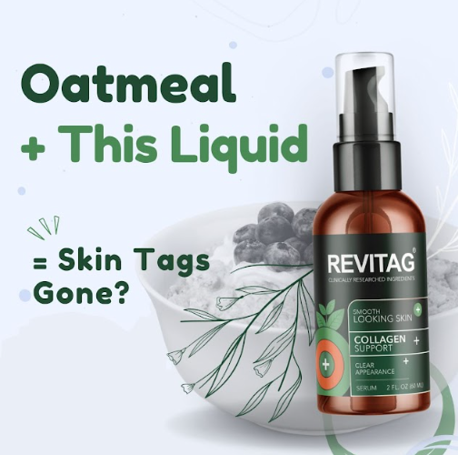 an image of a bottle of Revitag skin tag serum
